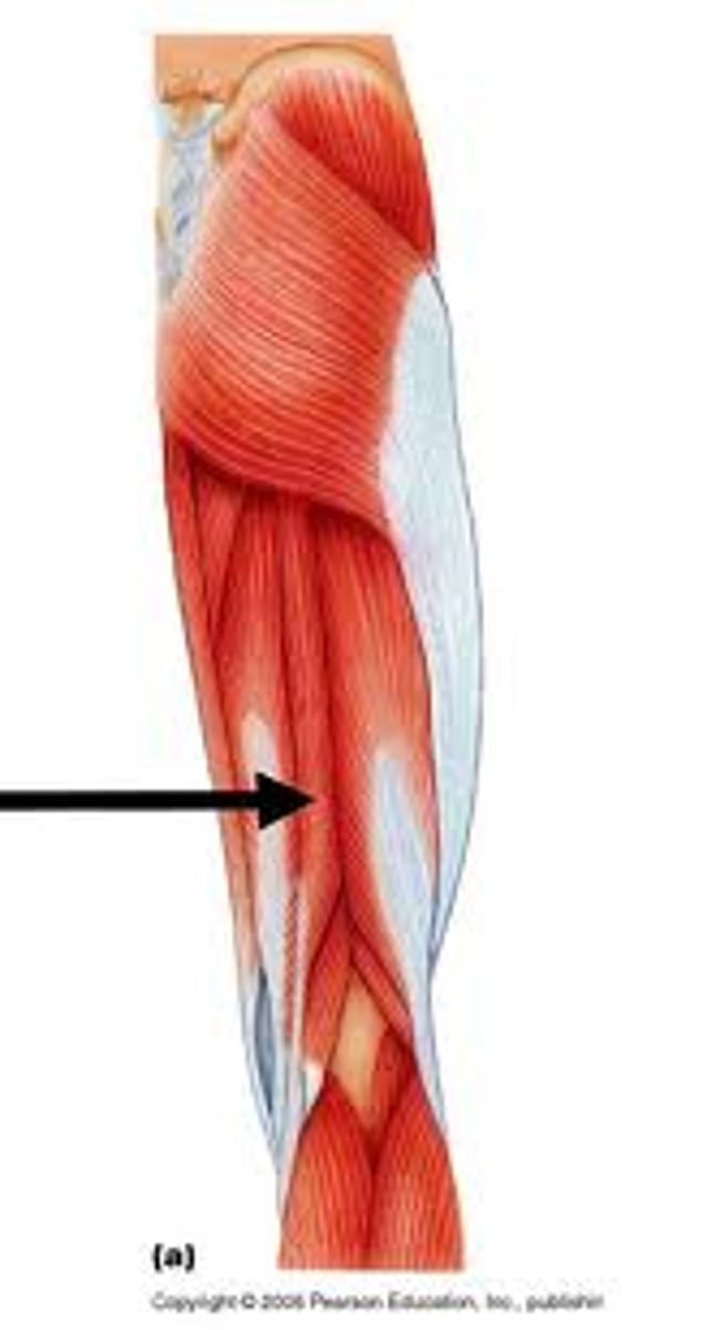 <p>posterior hamstring, long skinny tendon</p>