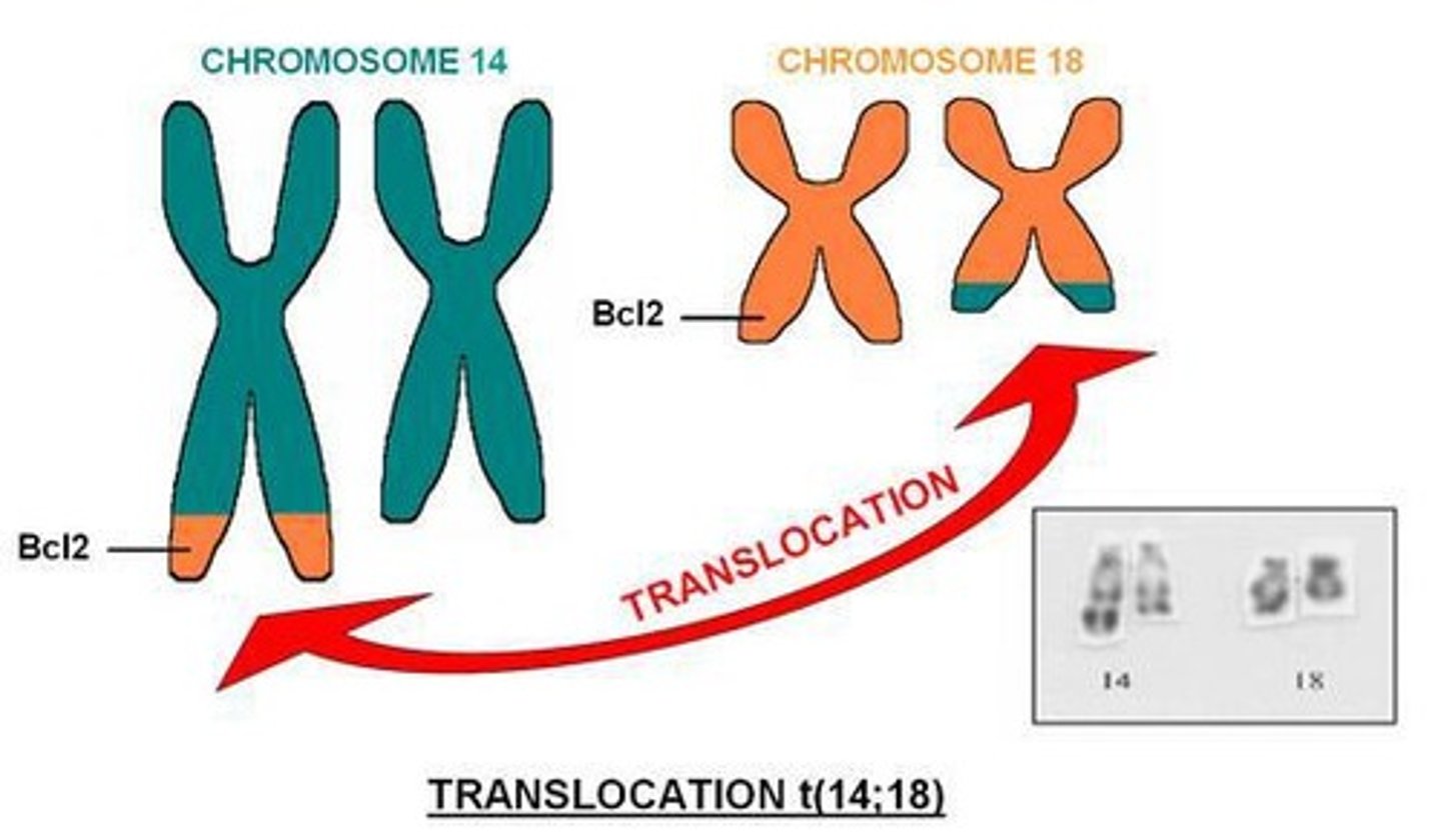 <p>It is associated with chronic myeloid leukemia (CML) and results from a translocation between chromosomes 9 and 22.</p>
