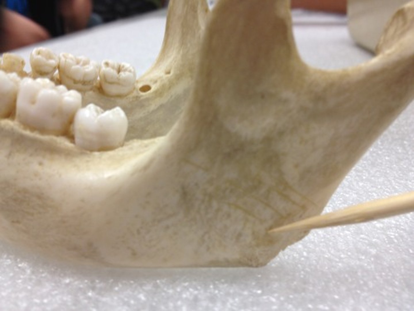 <p>rough area &amp; hollow on lateral surface of angle &amp; ramus where masseter muscle attaches</p>