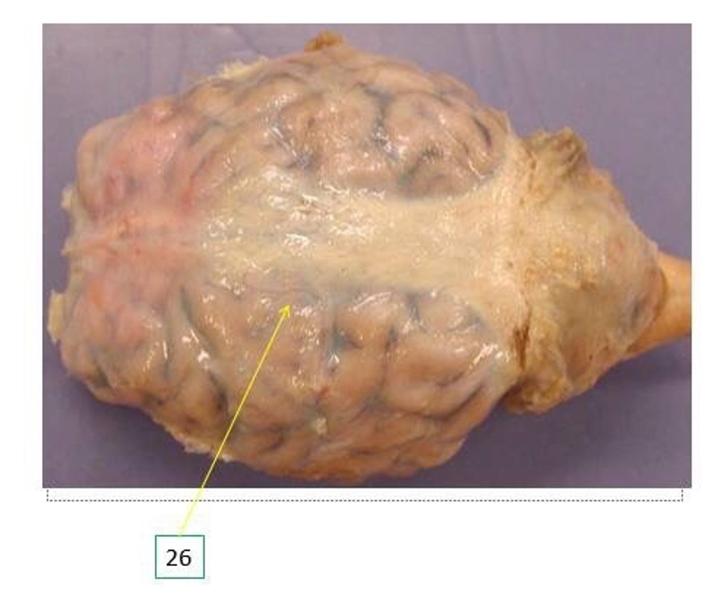 <p>(Top layer) White covering surrounding the brain.</p>