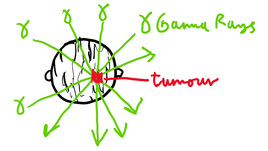 <p>Cancer treatment - radiotherapy:</p><p>Gives a high dose of gamma rays to the tumour, aiming to kill it.</p>