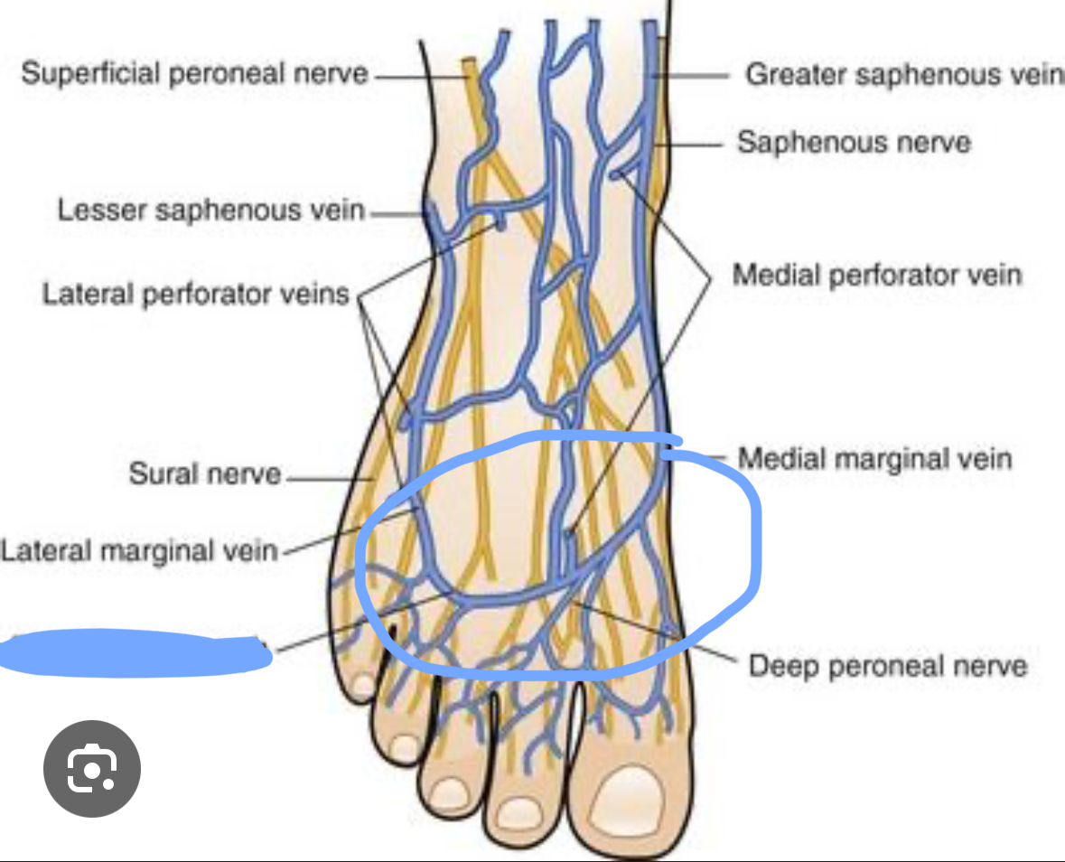 <p>Look at the arch shape of this vein</p>
