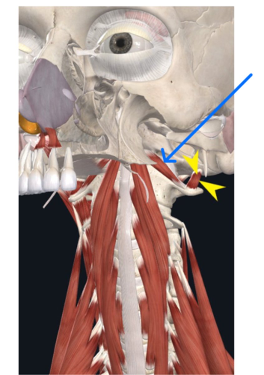 <p>What muscle is the blue arrow pointing to?</p>