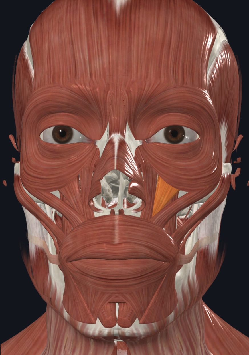 term image