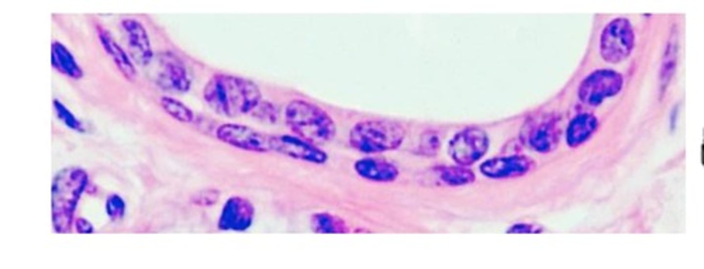 <p>more than 1 layer of cells; apical layer is cuboidal, not common.</p><p>Typical locations: duct systems</p>