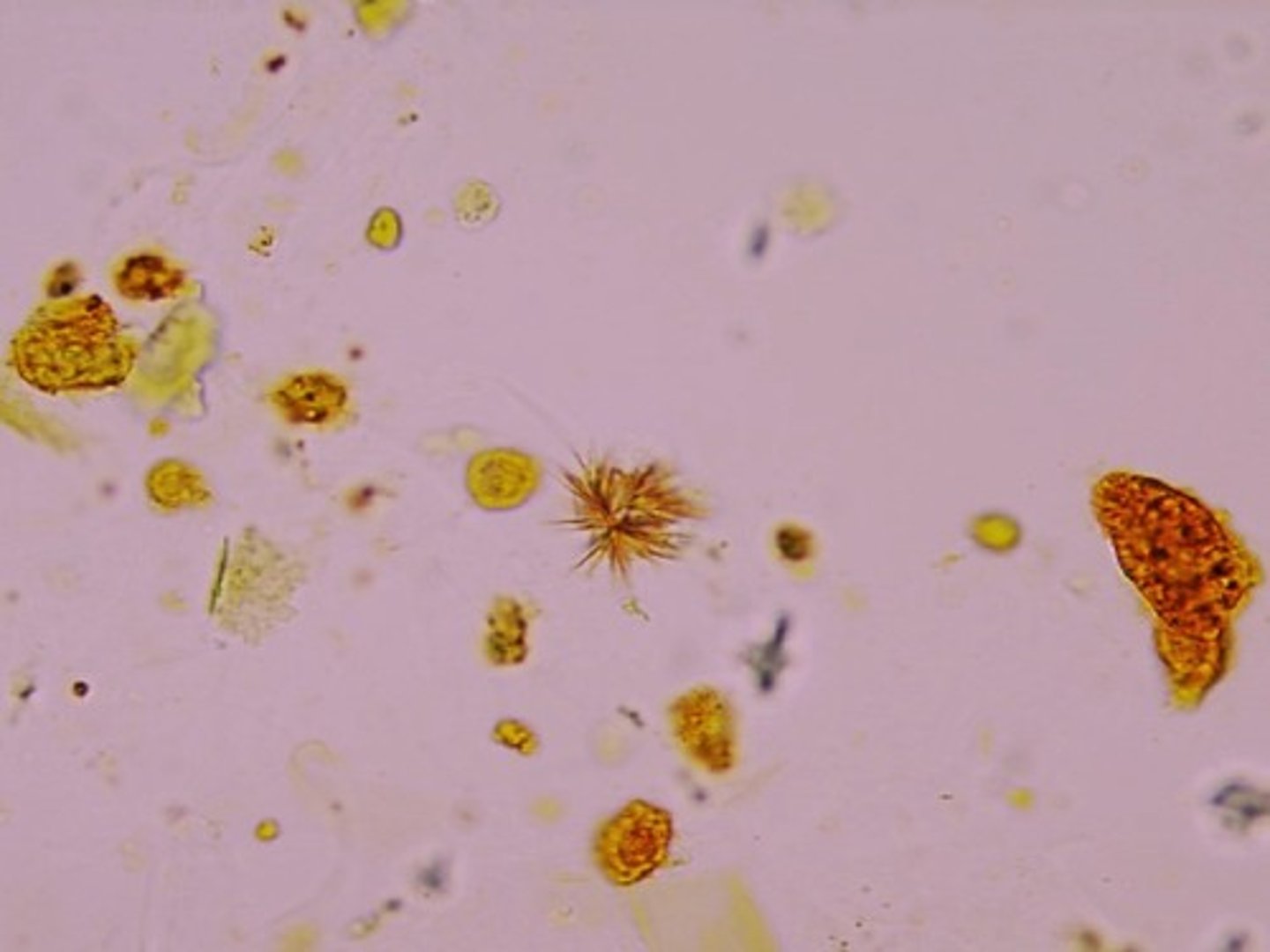 <p>A yellow pigment; formed by the breakdown of the heme group of hemoglobin when red blood cells are destroyed --> released by liver in bile</p>