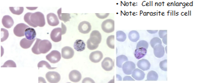 <p>What is the genus, species, and stage of this parasite?</p>