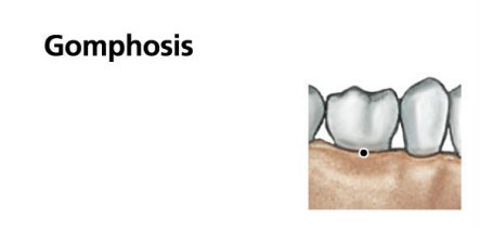<p>Gomphosis? What is the functional classification of the joint?</p>