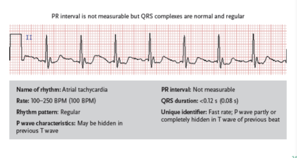 <p>a fast atrial rhythm caused by irritability in the atria, with a rate of 160–250 BPM</p>