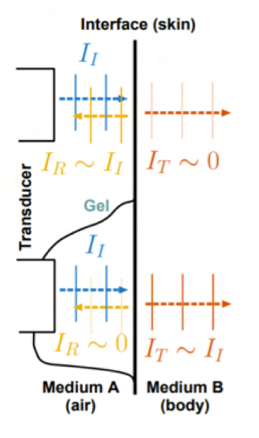 <p>Since the wave is generated in air (which has low impedence), most of the wave that reaches the body (which has high impedance) is reflected at the skin and only shows skin int he imaging, therefore gell (with high impetence) allows for th wave to be generated in high impentence and so be absorrbed through the skin and be reflected only by organs within the body with different impetences. </p>