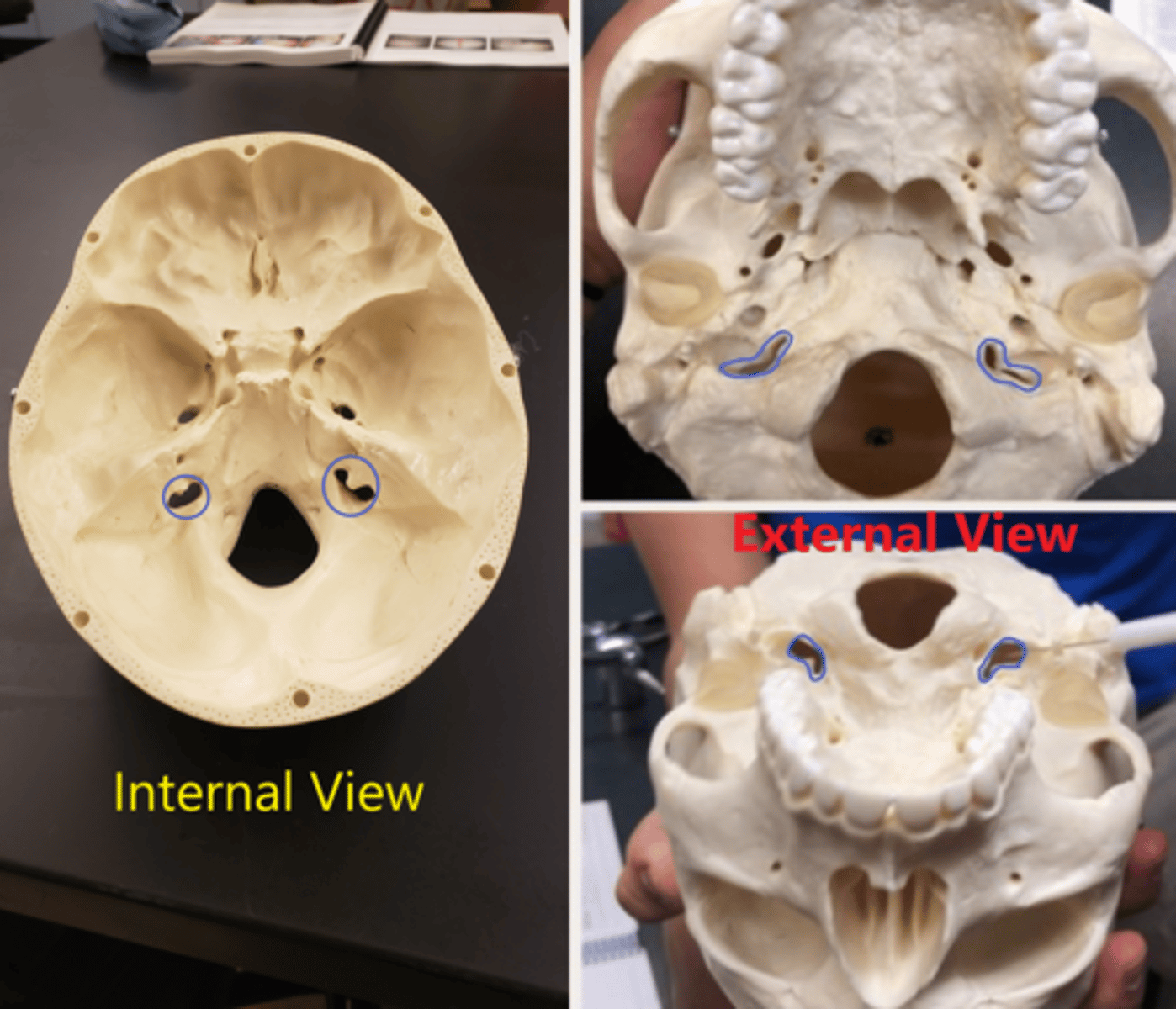 <p>Holes just outside occipital condyles</p>