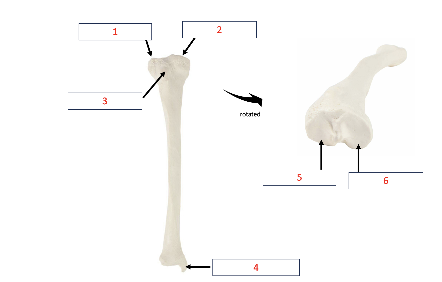 <p>Tibial - medial malleolus </p>