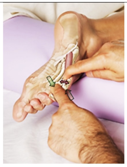 <p>flexor digiti minimi pedis</p>