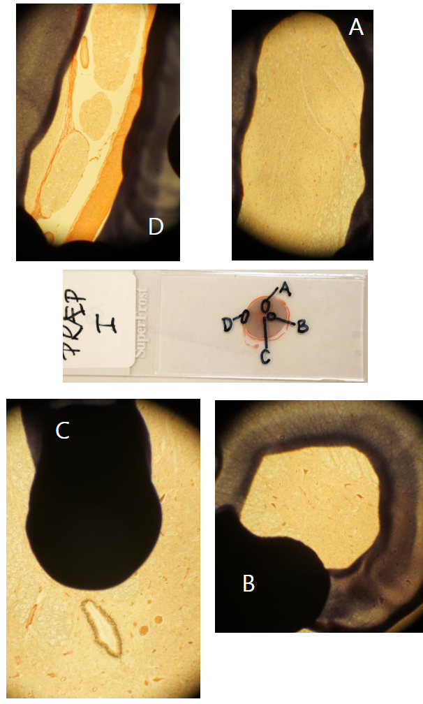 **Post 5.**

__Præparat I: Histologisk snit af del af CNS (Medulla spinalis)__

\
**Spørgsmål 4:** Benævn strukturen D.