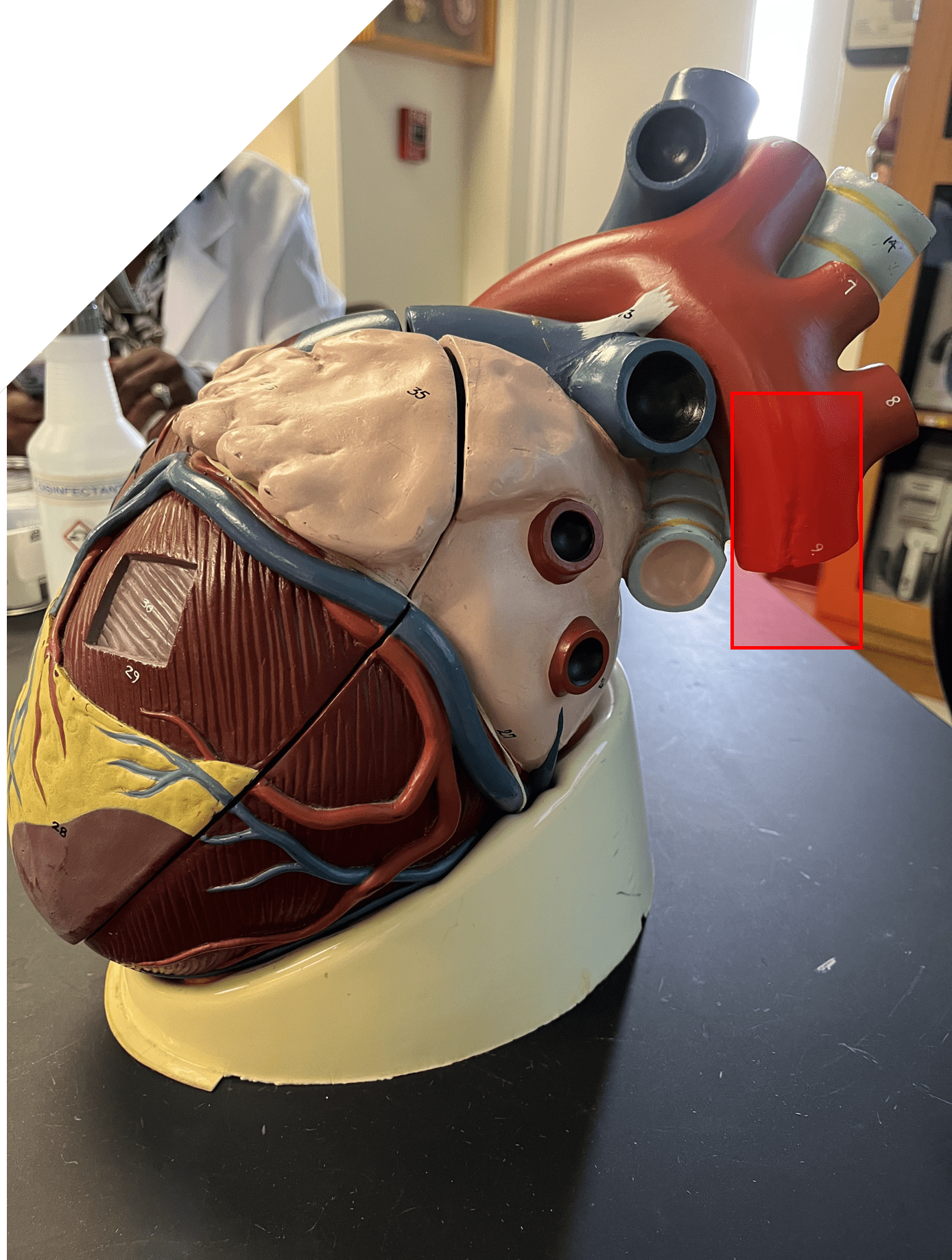 The part of the aorta that descends posteriorly.