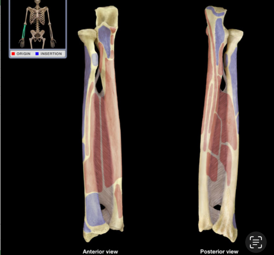 <p>What bones are shown?</p>