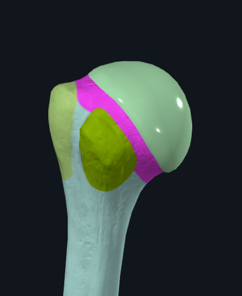 <p>What is this part of the humerus called</p>