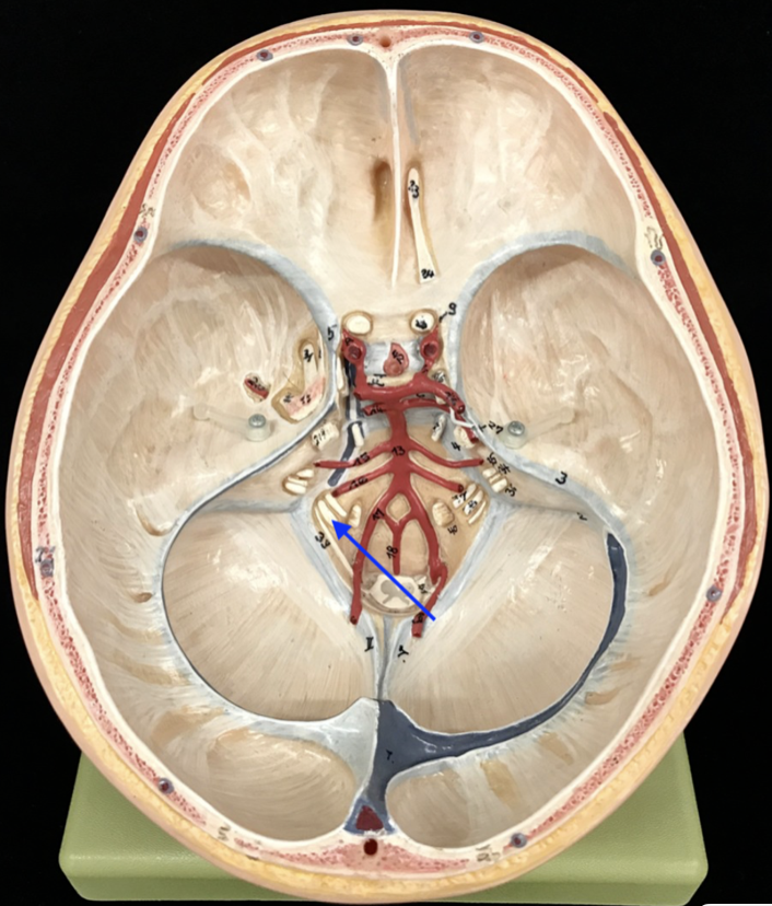 <p>What is the cranial nerve and roman numeral?</p>