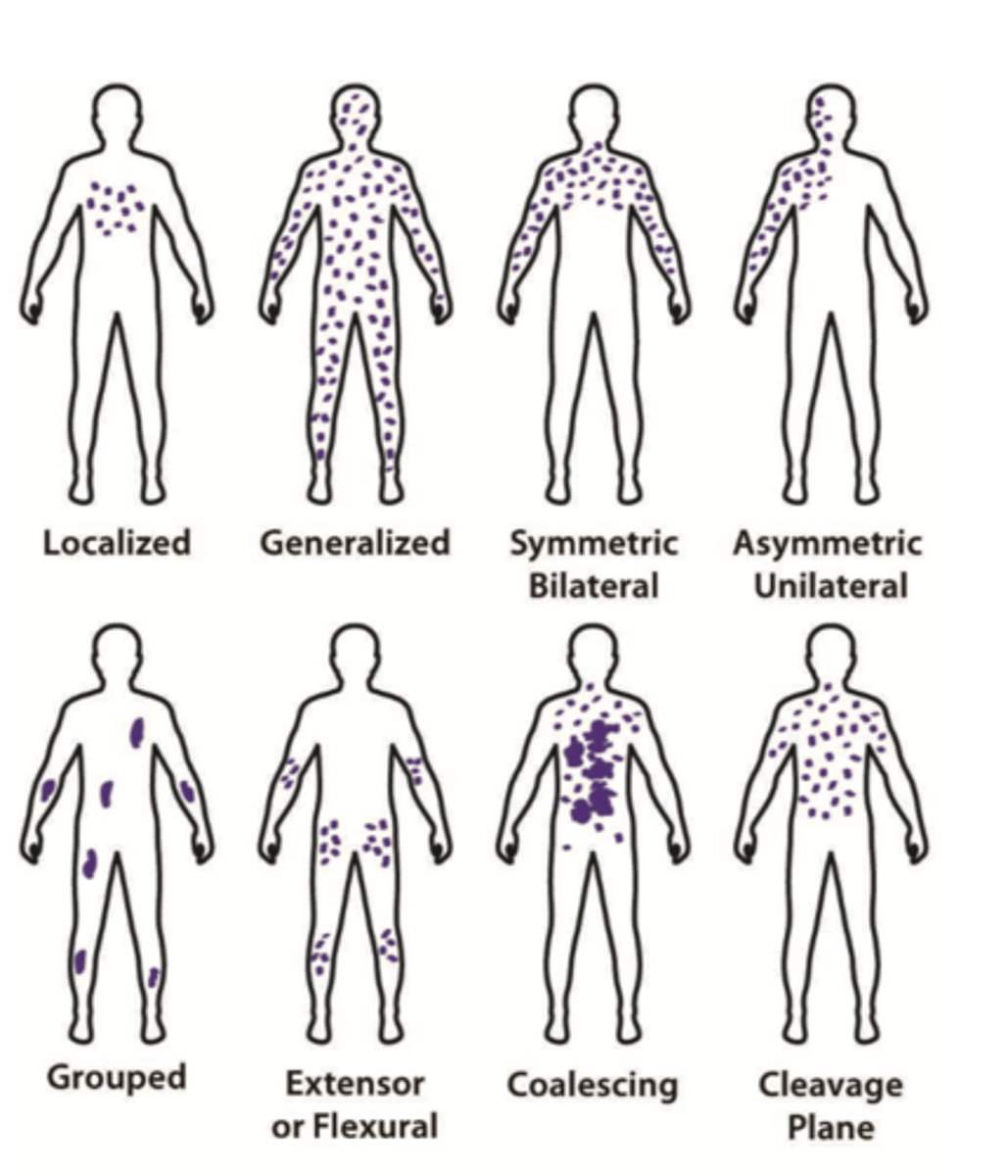 <p>Distribution</p>