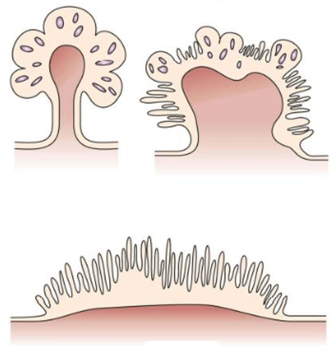 <p>Polyp, small growth</p>