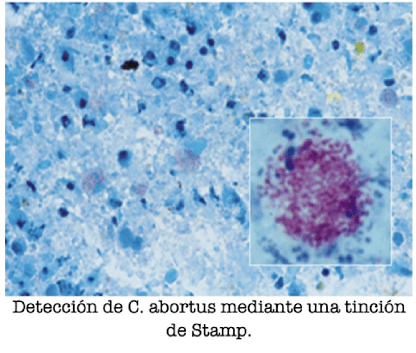 <p>tinción de stamp</p><p>PCR, ICQ</p>