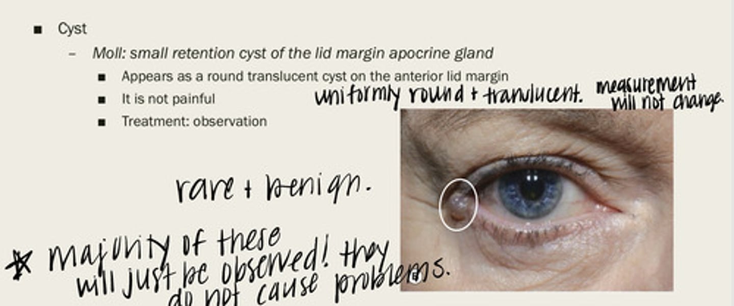 <p>Are moll cysts typically painful?</p>