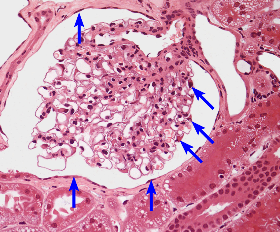 <p>double walled structure enclosing the glomerulus</p>