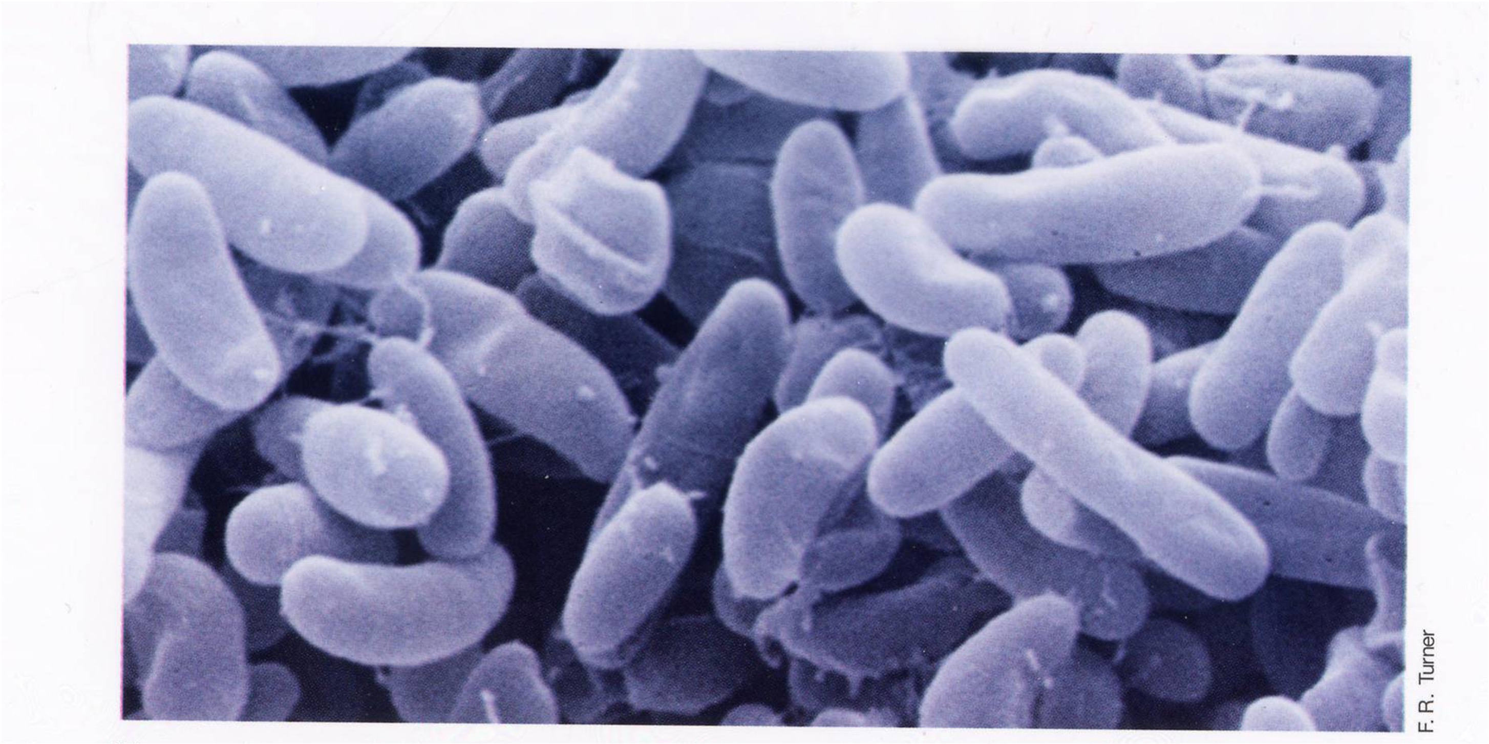 <p>It uses a thin film of heavy metals like gold. it has magnification from 15X to 100,000X and uses an electron beam to scan back and forth, creating a 3d rendering. It is good for looking at the surface of bacteria.</p>