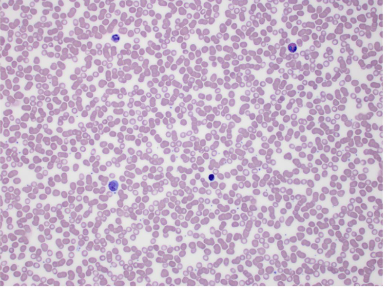 <p>what tissue is this </p>