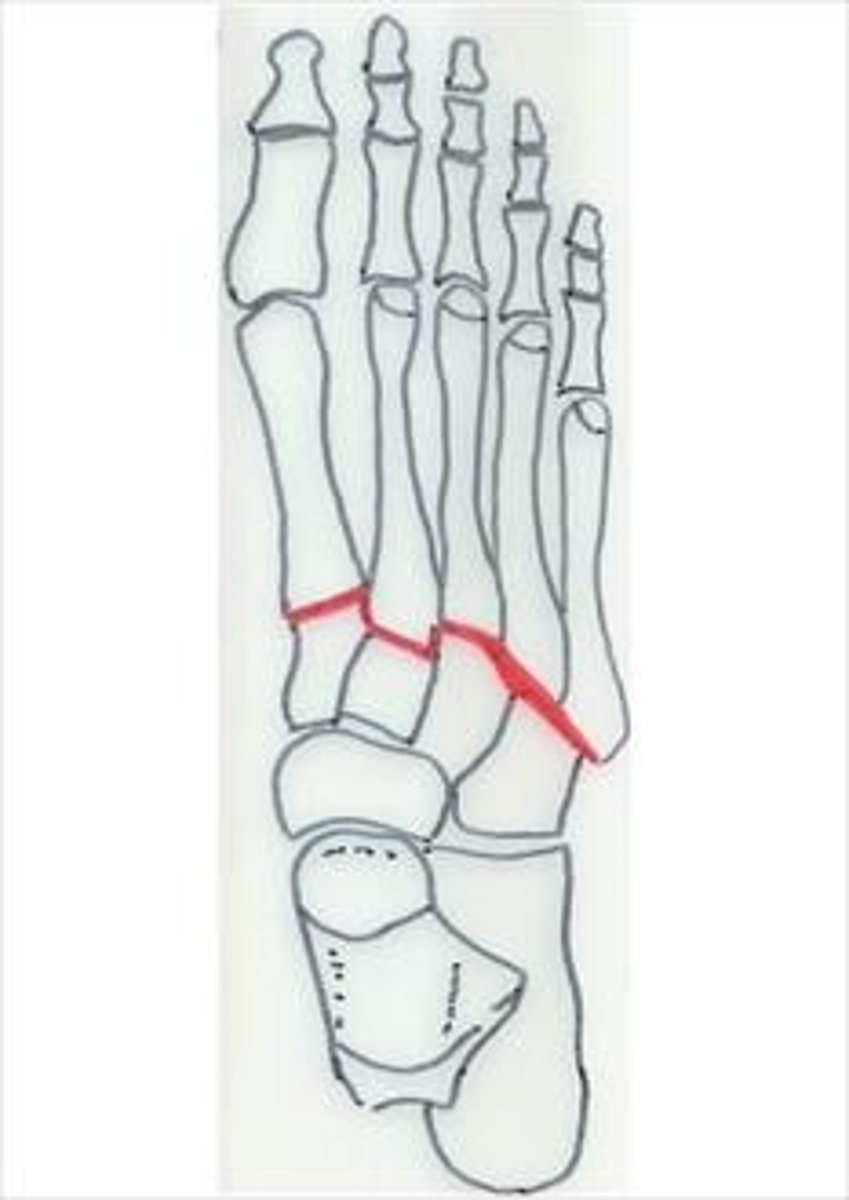 <p>between ankle and foot bones</p>