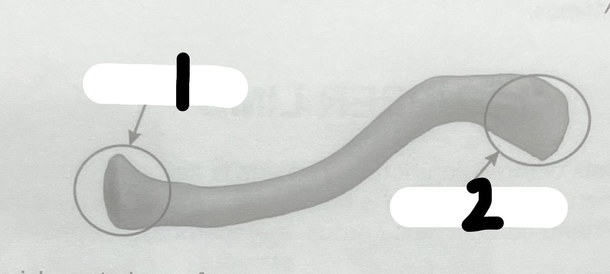 <p>What’s the name of this bone?</p>