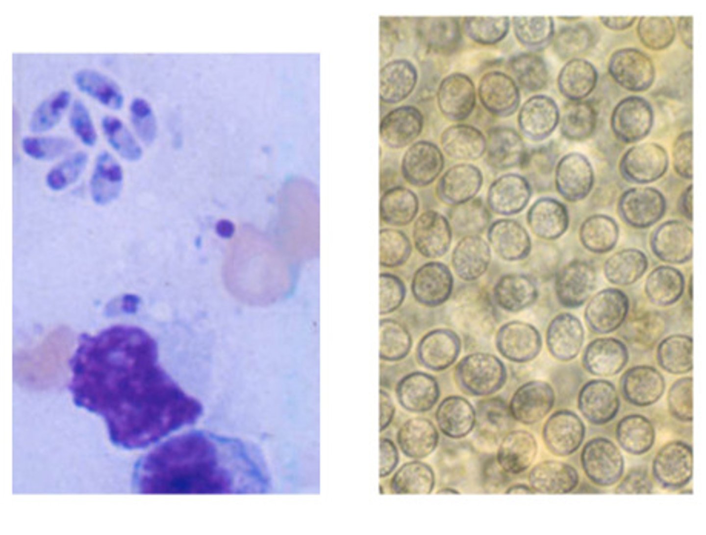 <p>ID the following parasite (cats)</p>