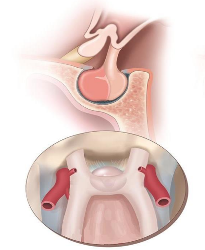 term image