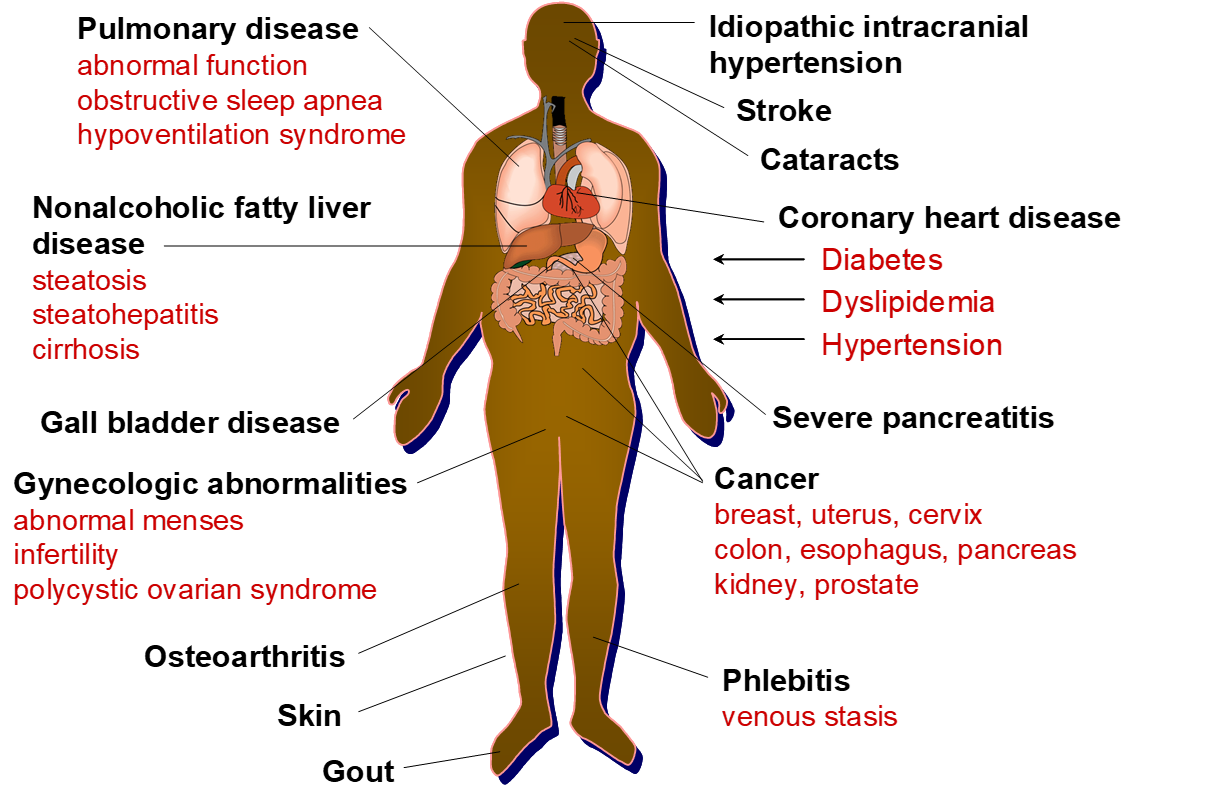 <p>What causes polypharmacy (taking multiple medications)?</p>
