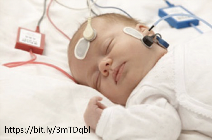 <p>Krizmen et al</p>