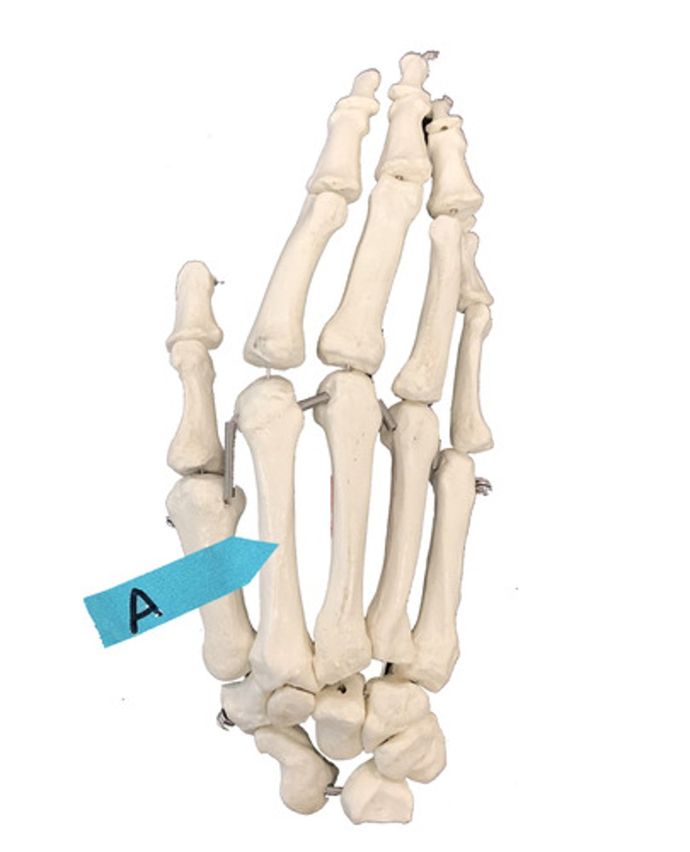 <p>Identify this bone.</p>