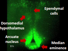 <ul><li><p>neuronal and non-neuronal rhythms are found in the medio-basal hypothalamus </p></li><li><p>first single-cell recordings of circadian oscillations elsewhere in the brain&nbsp;</p></li><li><p>HE less robustness, amplitude and synchrony in contrast to the SCN</p></li></ul><p></p>