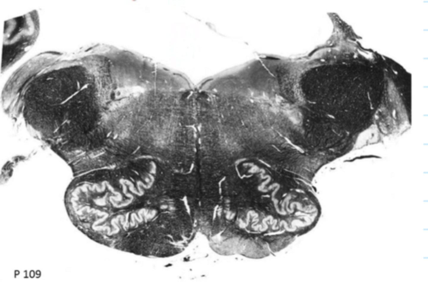 <p>ID the brainstem level</p>