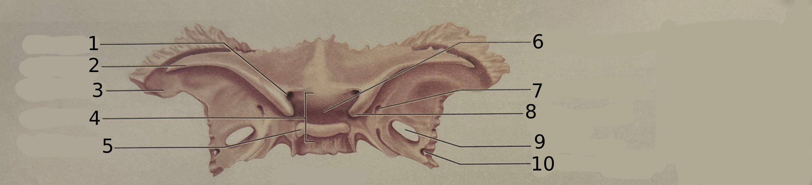 <p>#1</p>