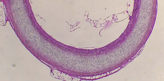 <p>What is the histology?</p>