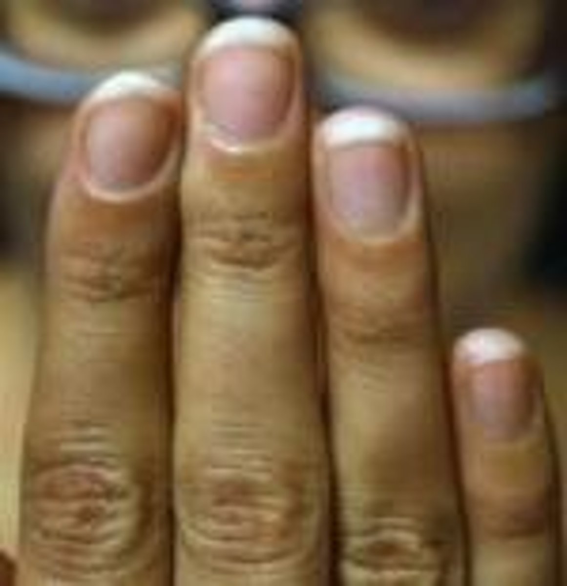 <p>fingers, toes</p>