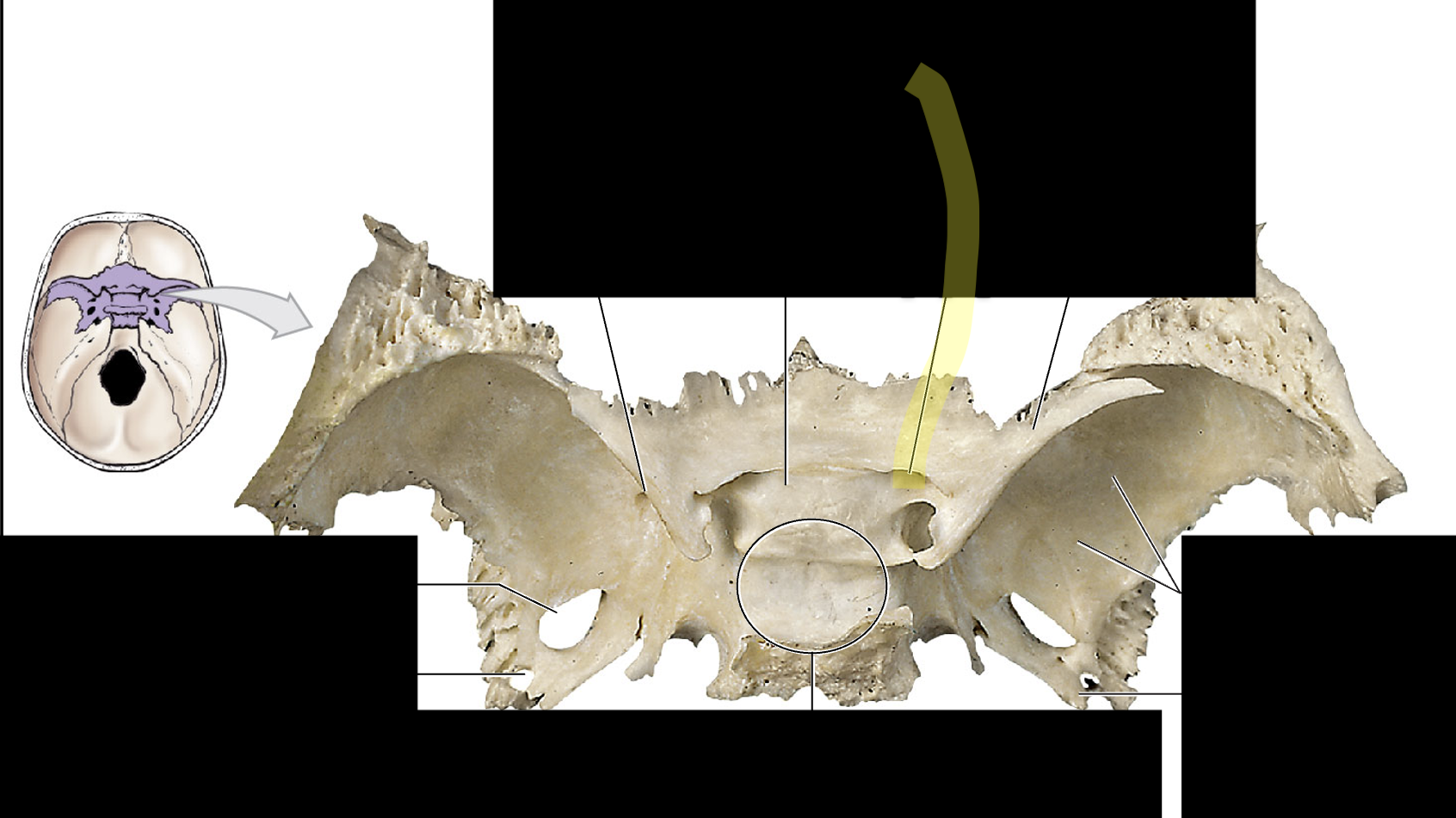 <p>optic foramen;<strong> hole for the optic nerve</strong></p>