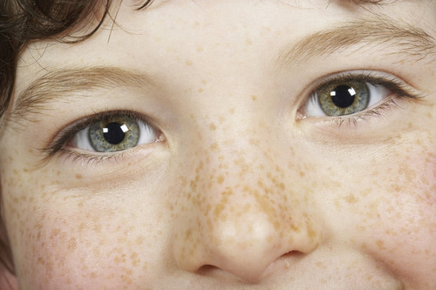 <p>I have freckles</p>