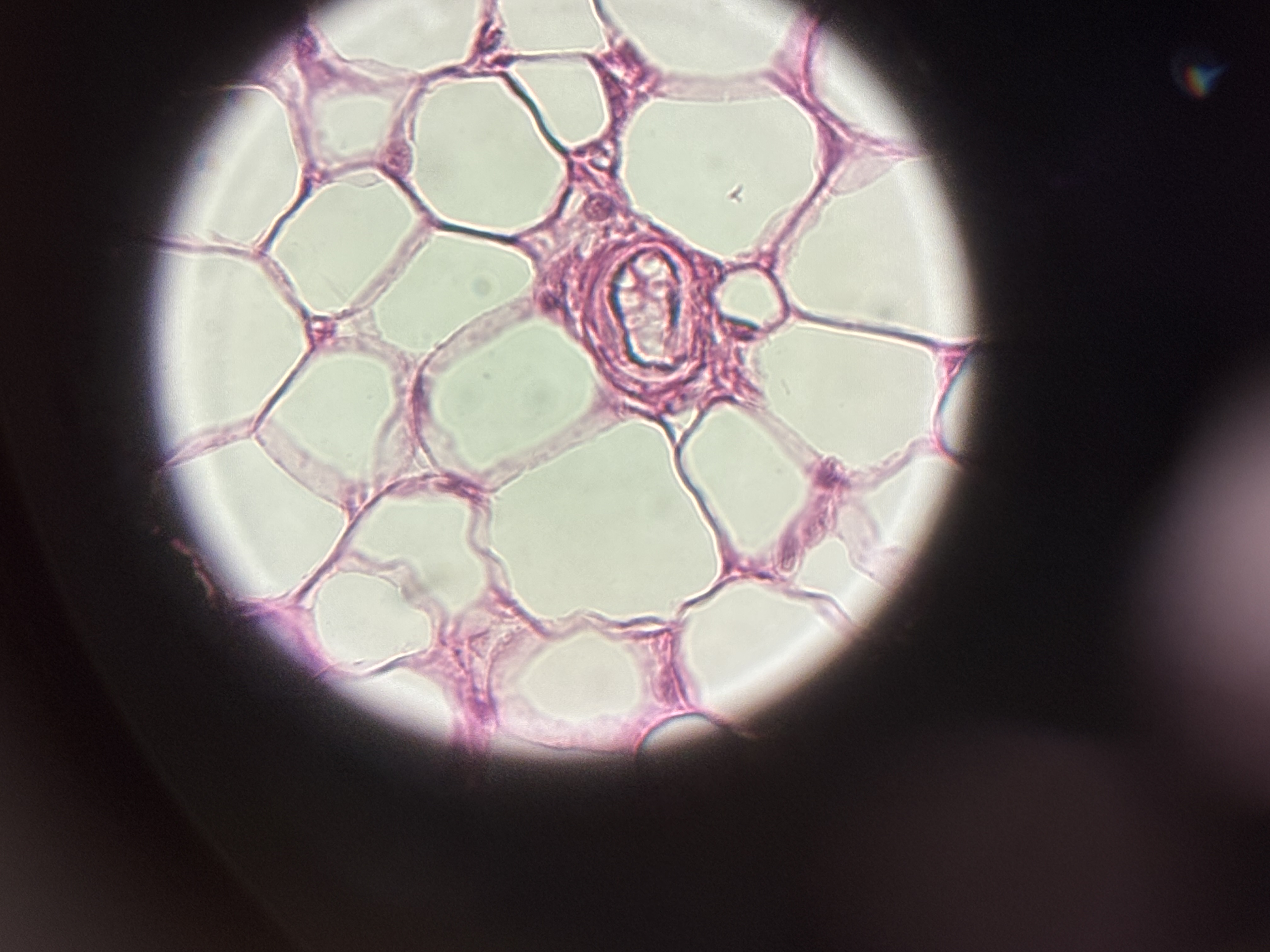 <p><span>Adipose CT</span></p>
