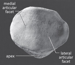 <p>NOT ON EVERY PATELLA, little notch cutting into superior lateral margin/surface</p>