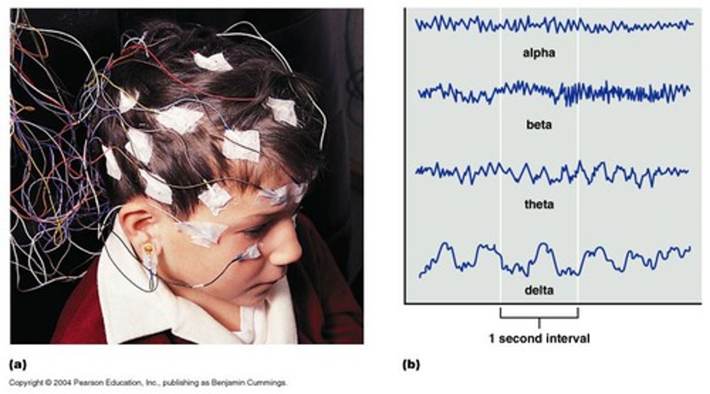 <p>- when many millions of neurons are active at the same time, the current generated is strong enough to be detected on the surface of the scalp with sensitive electrodes</p><p>- cap with electrodes</p><p>- studies electrical activity of the brain</p><p>- each electrode measures activity from many different parts of the brain -&gt; limitation because you cannot measure very specific parts of the brain</p><p>bad spatial resolution</p><p>very good temporal resolution (milliseconds): </p><p>- allows us to very quickly see how brain activity changes</p><p>- can show changes in consciousness (ex. sleep studies, epilepsy, comas, attention)</p>