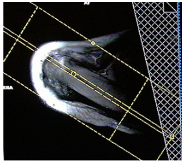 <p>What images will be created with this slice prescription ?</p>