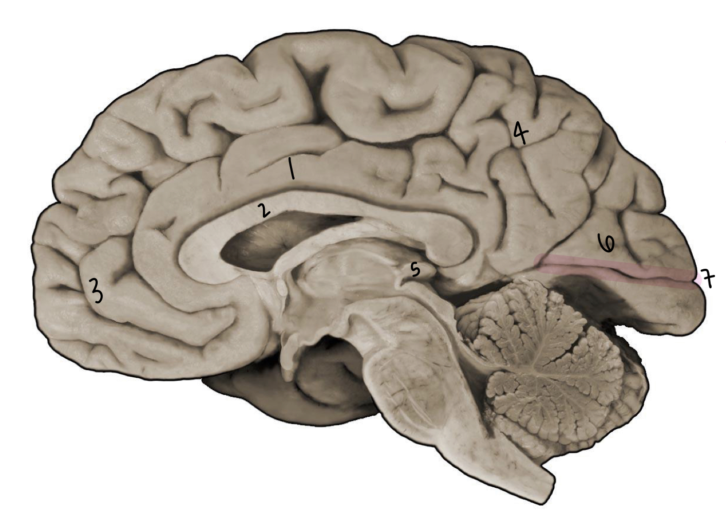 <p>What structure is labeled 7?</p>