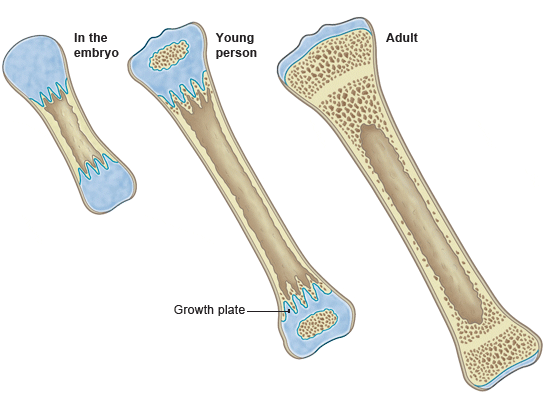 <p><strong>Interstitial growth occurs at the epiphyseal plates (growth plates)</strong>, which are hyaline cartilage plates between the epiphysis and diaphysis of long bones. Chondrocytes proliferate, and bone replaces cartilage, lengthening the bone until the plates ossify (forming the epiphyseal line) after puberty.</p>