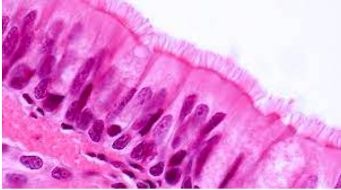 <ul><li><p>one layer of nonuniform cells</p></li><li><p>all cells are in contact with the basal membrane</p></li><li><p>found in the <strong>trachea, bronchi, and Eustachian tubes</strong></p></li></ul><p></p>